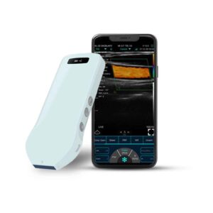 C10-CS – Wireless Convex Color Doppler Ultrasound Probe