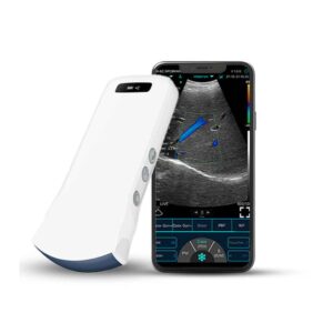 C10RN – Wireless Convex Ultrasound Probe