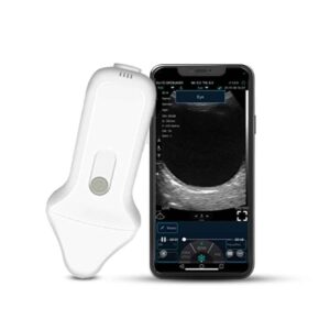 C10UE – Wireless Ophthalmic Ultrasound Probe