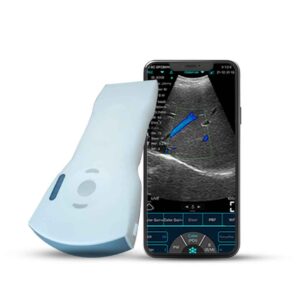 C10XS – Wireless Convex Color Doppler Ultrasound Probe